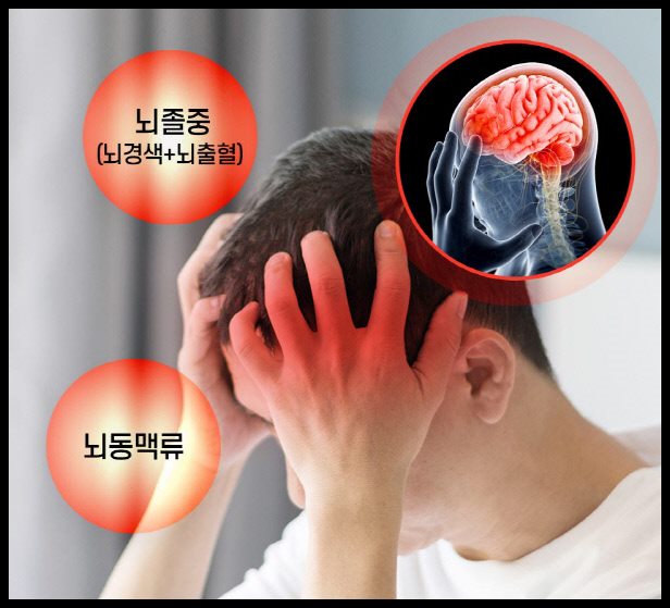 뇌혈관질환에 대해서